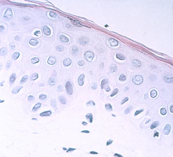 Normal epidermis