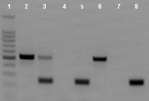 Agarose gel of PCR products