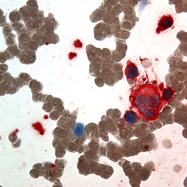 Tetraspanin
