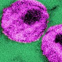 HIV affected cells