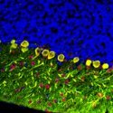 Purkinje neurons