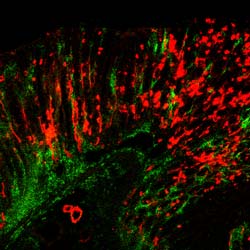 Parietal staining of cells for research