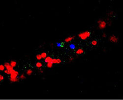 Adherent neutrophils (red) CD4 T cells (green) and CD8 T cells (blue) in a dermal venule during a contact sensitivity response