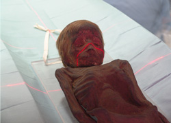 Mummified human remains of a boy