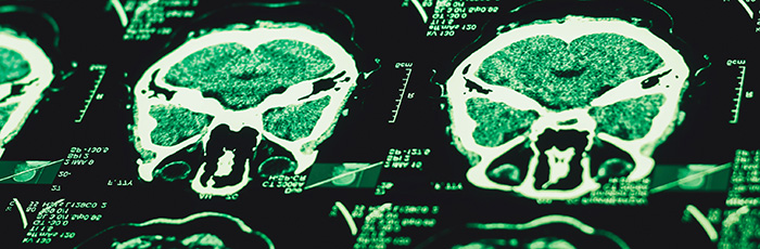 ct-scan