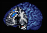 Brain Areas